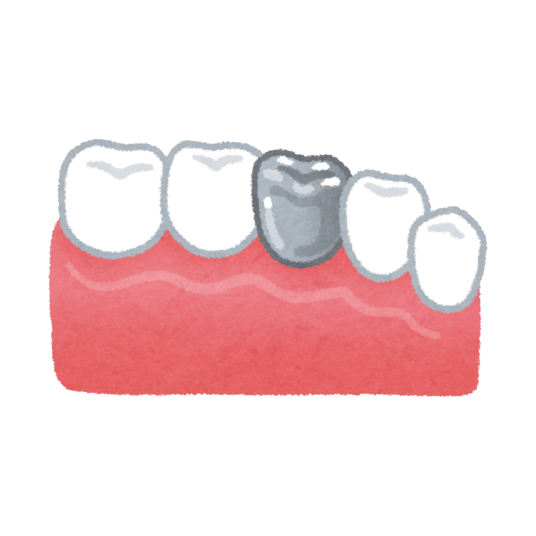 خدمات روکش دندان